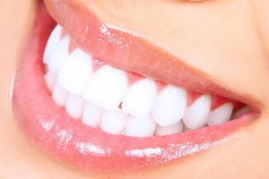 Teeth Whitening Glenview